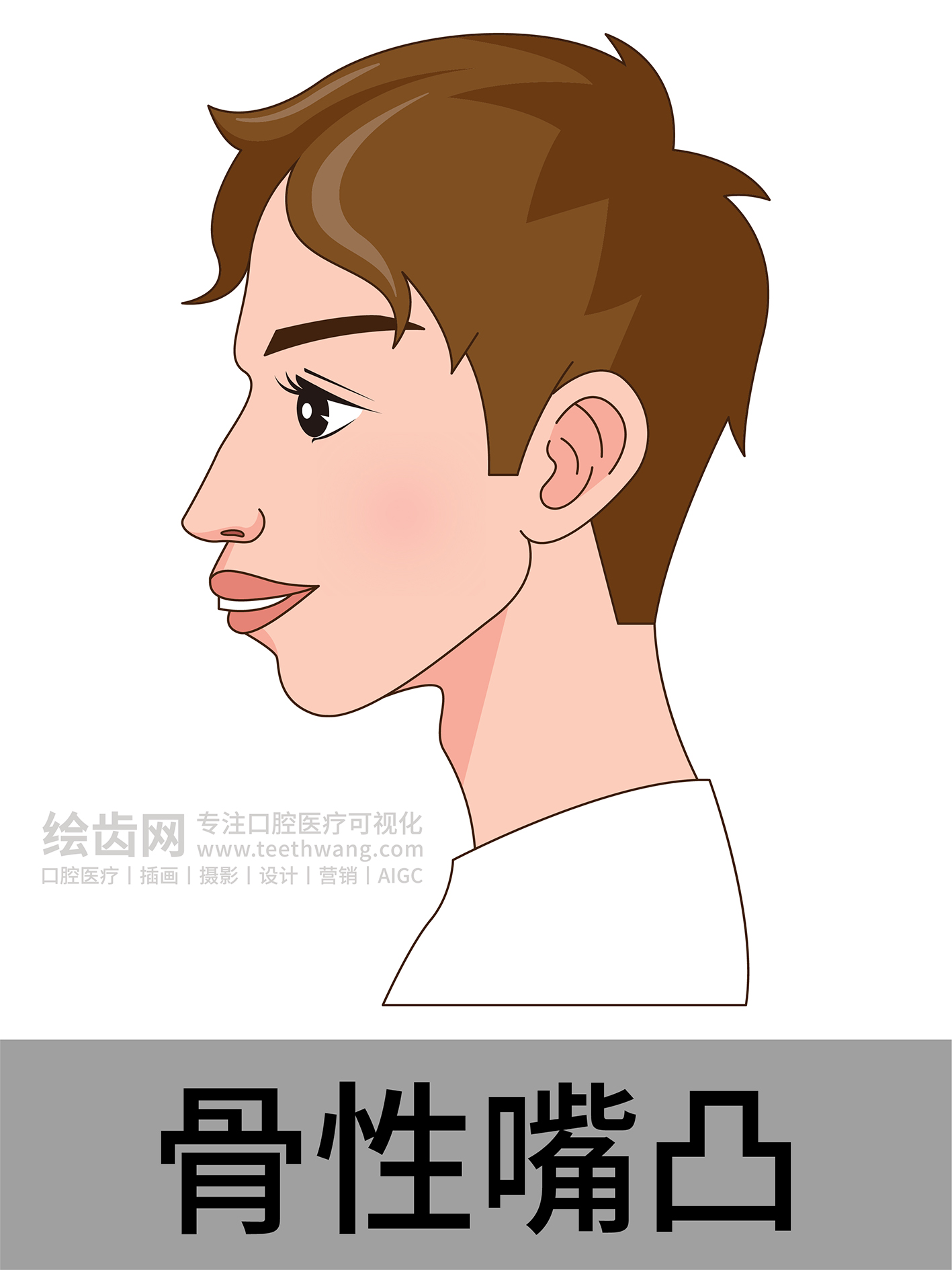 男孩侧脸 牙齿矫正类型 口腔医美插画