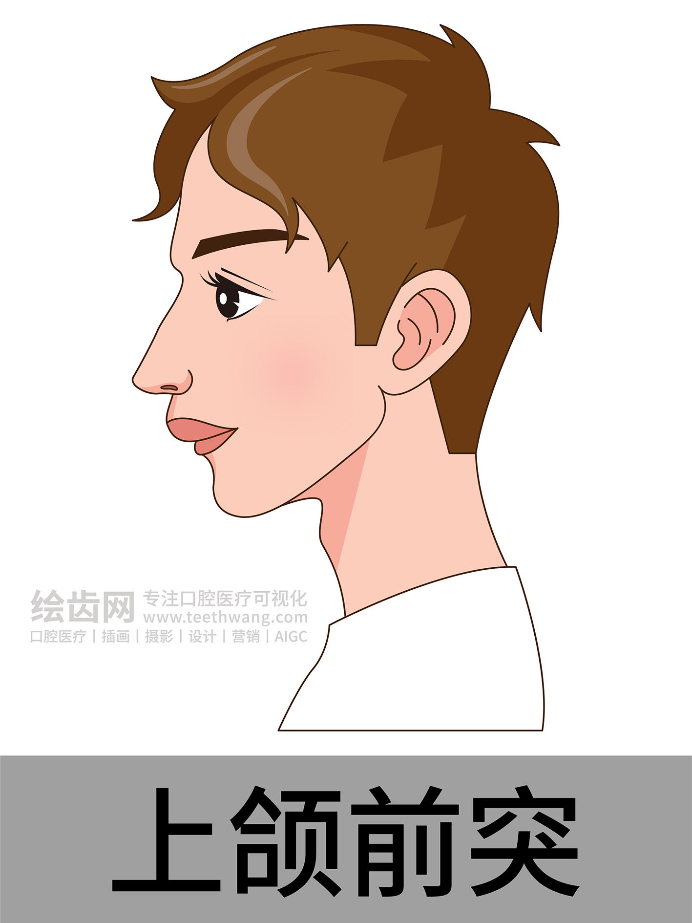 男孩侧脸 牙齿矫正类型 口腔医美插画