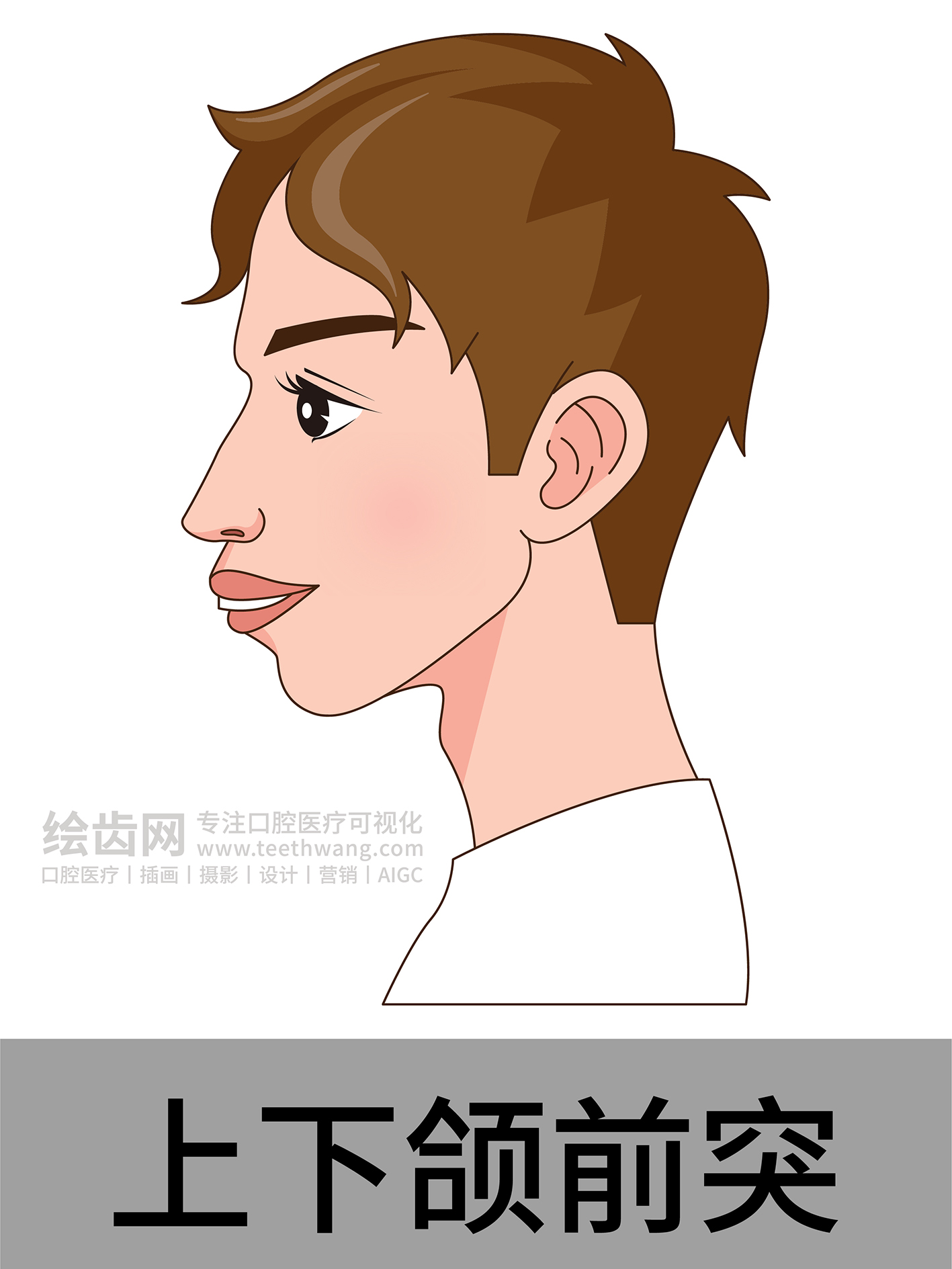 男孩侧脸 牙齿矫正类型 口腔医美插画