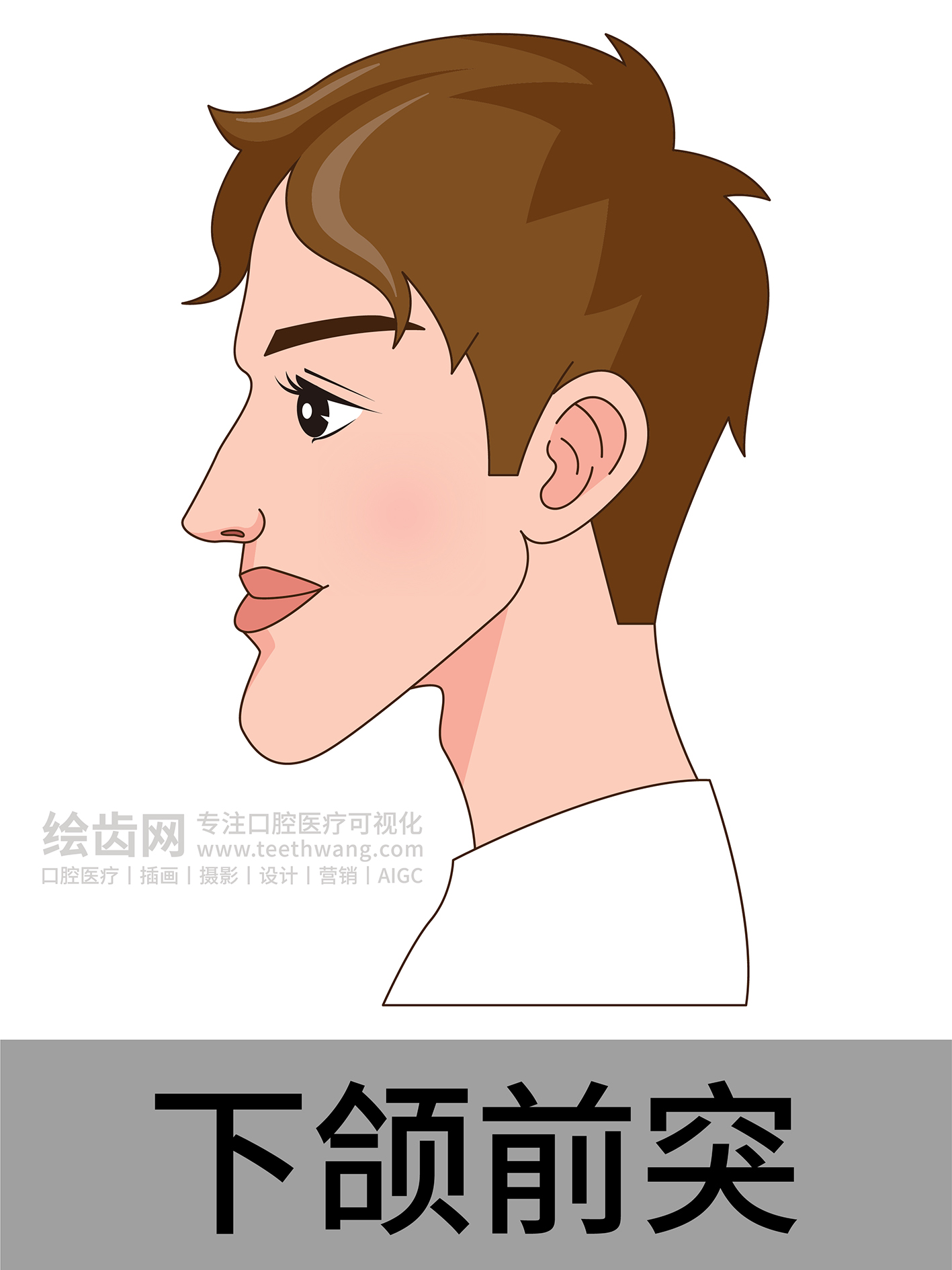 男孩侧脸 牙齿矫正类型 口腔医美插画