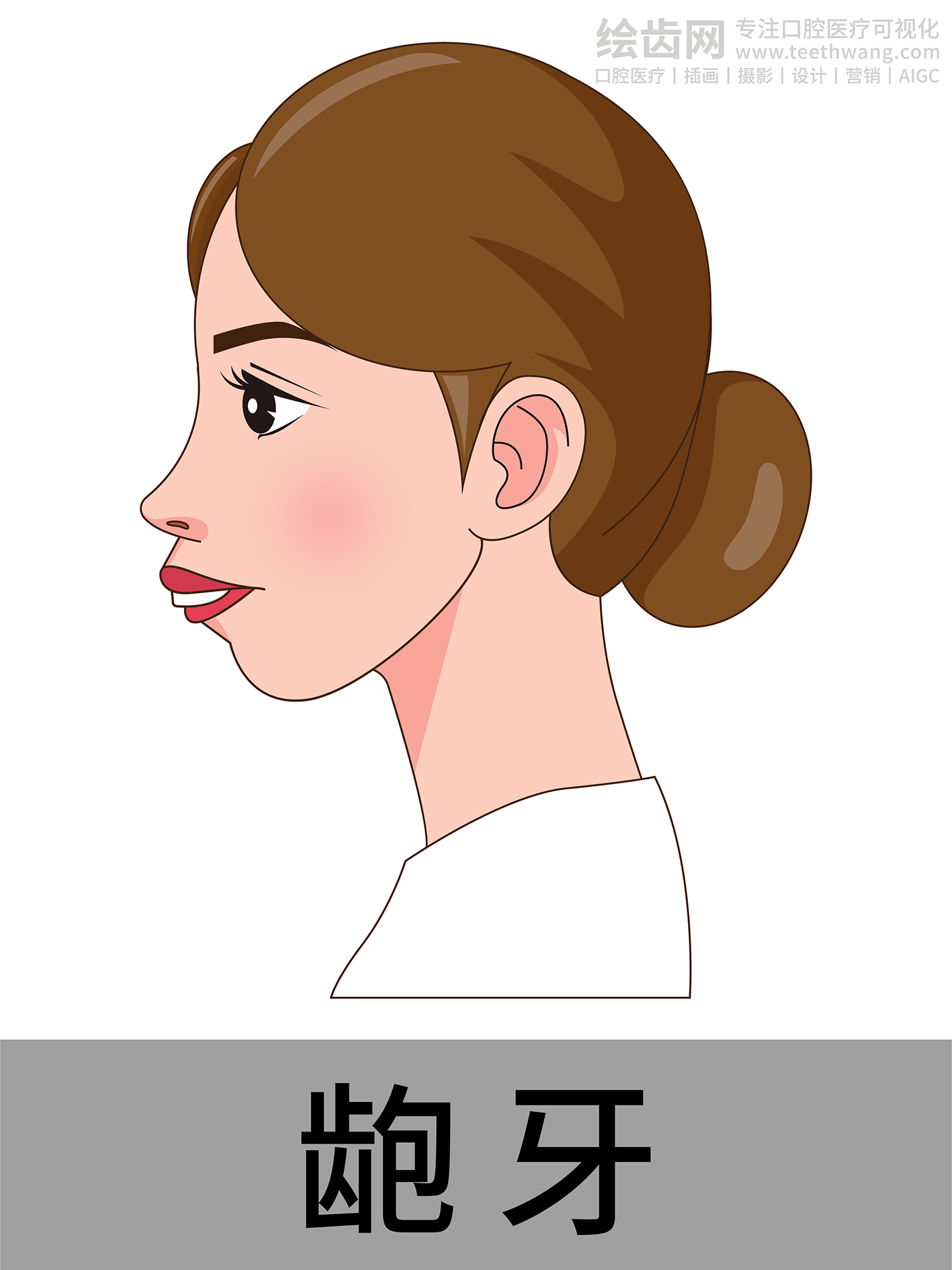 女孩侧脸 牙齿矫正类型 口腔医美插画