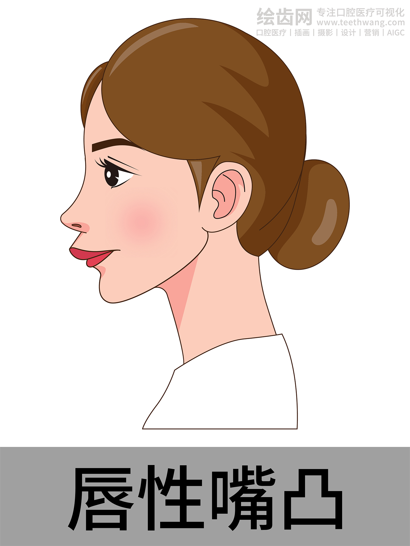 女孩侧脸 牙齿矫正类型 口腔医美插画
