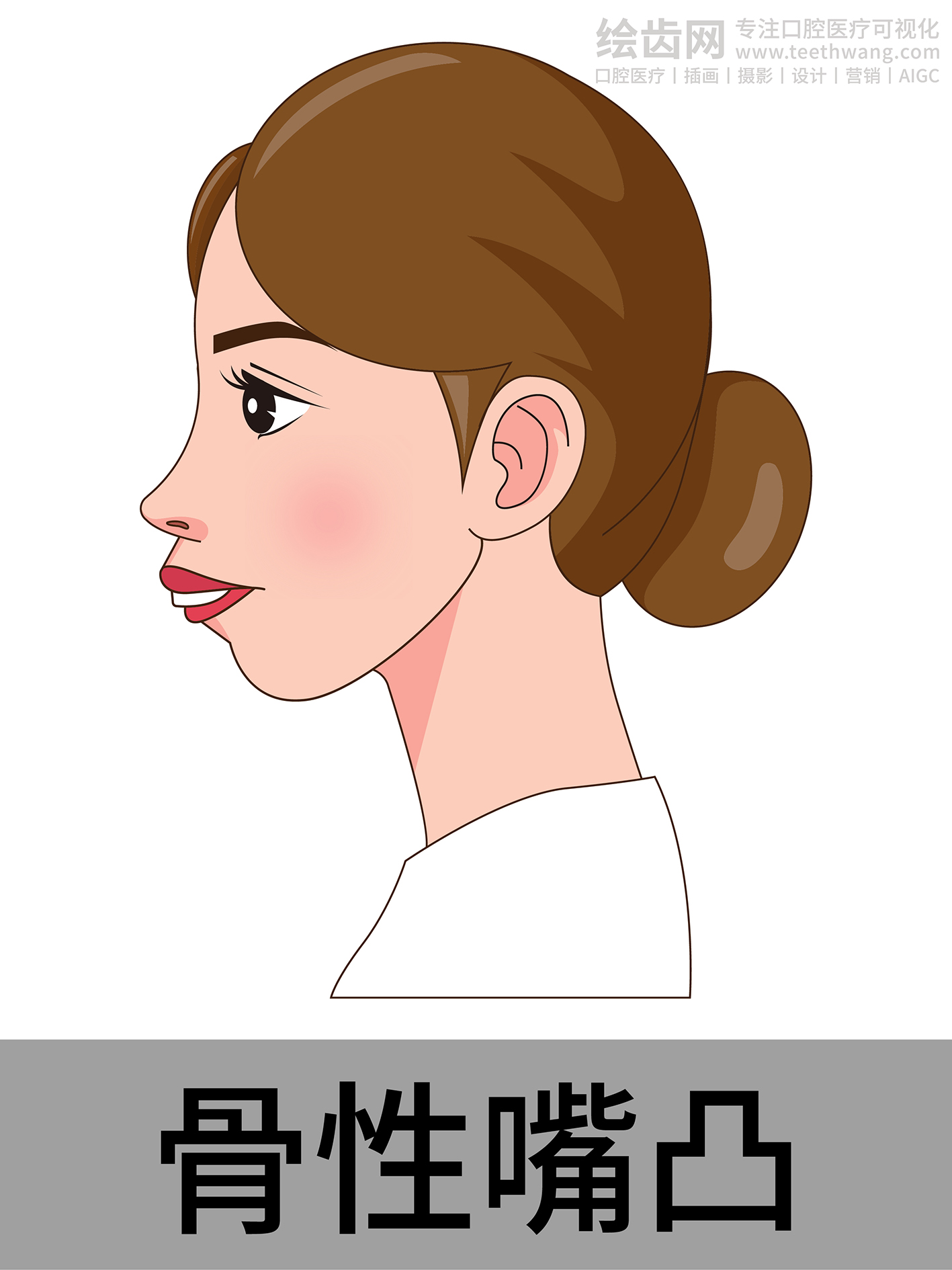 女孩侧脸 牙齿矫正类型 口腔医美插画
