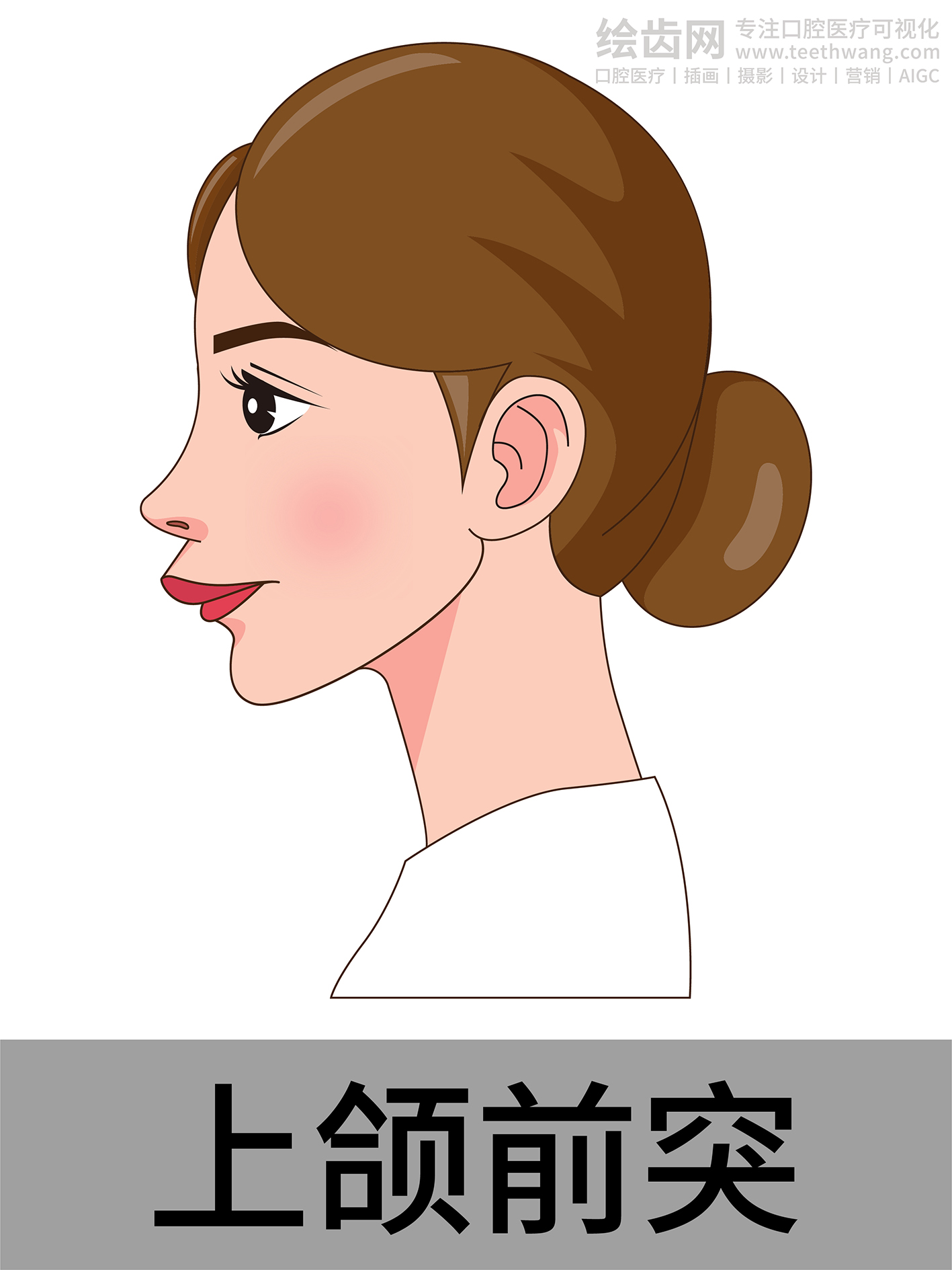 女孩侧脸 牙齿矫正类型 口腔医美插画