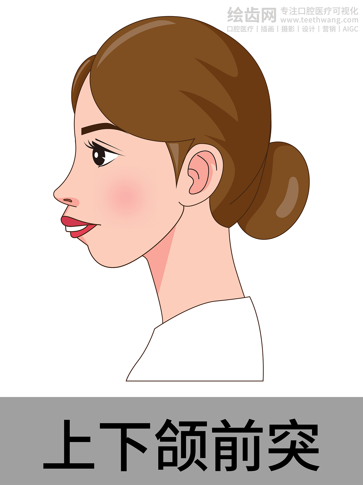 女孩侧脸 牙齿矫正类型 口腔医美插画