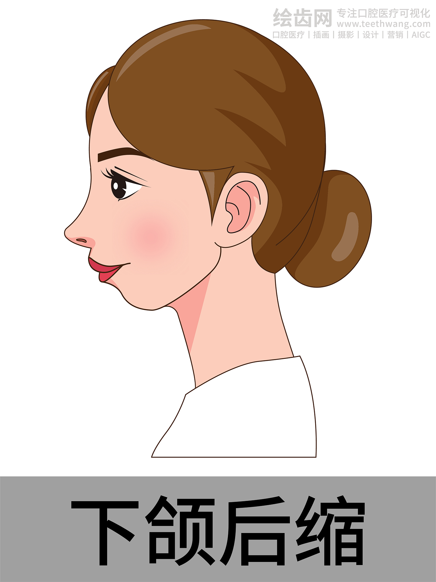 女孩侧脸 牙齿矫正类型 口腔医美插画