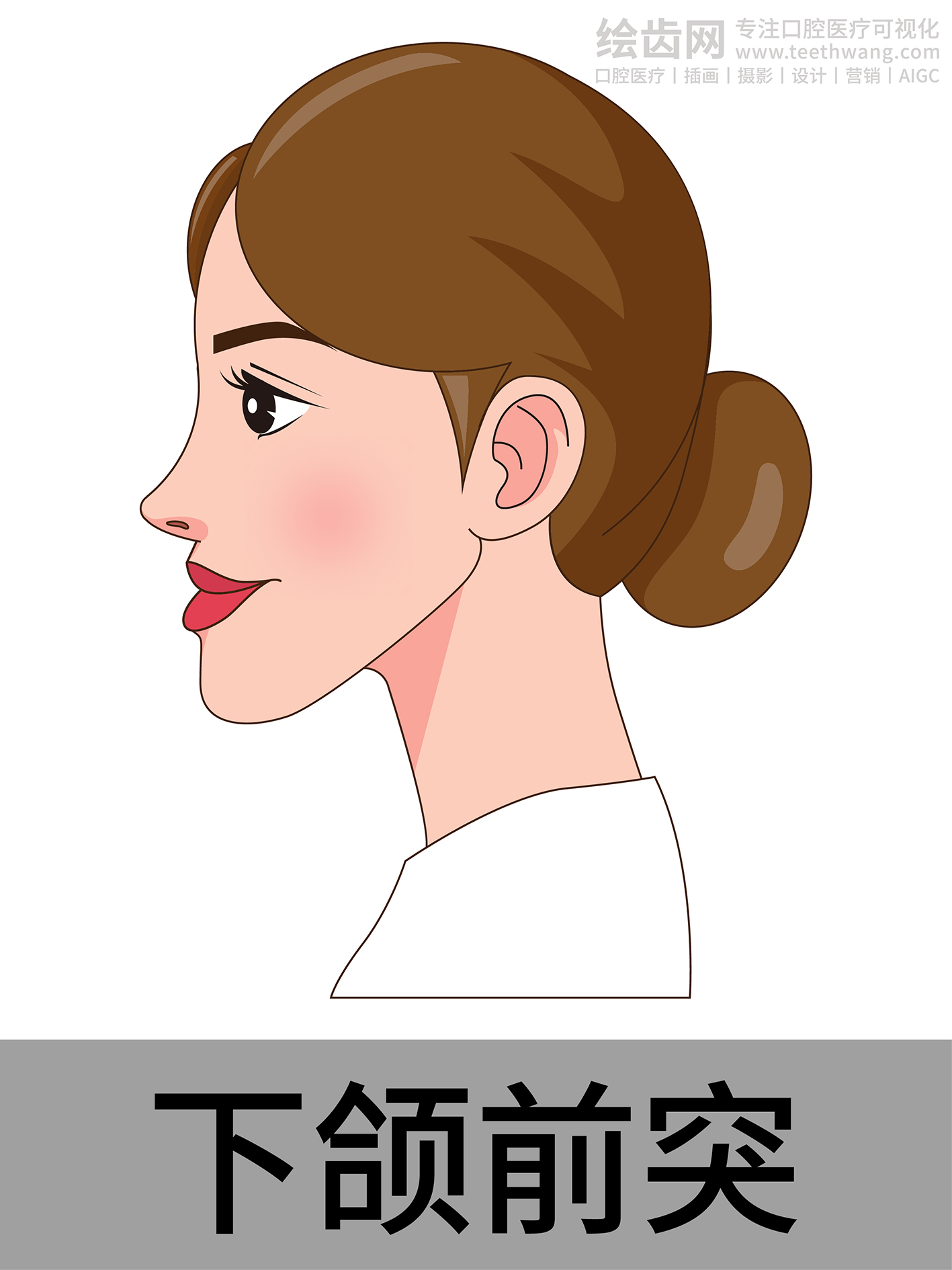 女孩侧脸 牙齿矫正类型 口腔医美插画