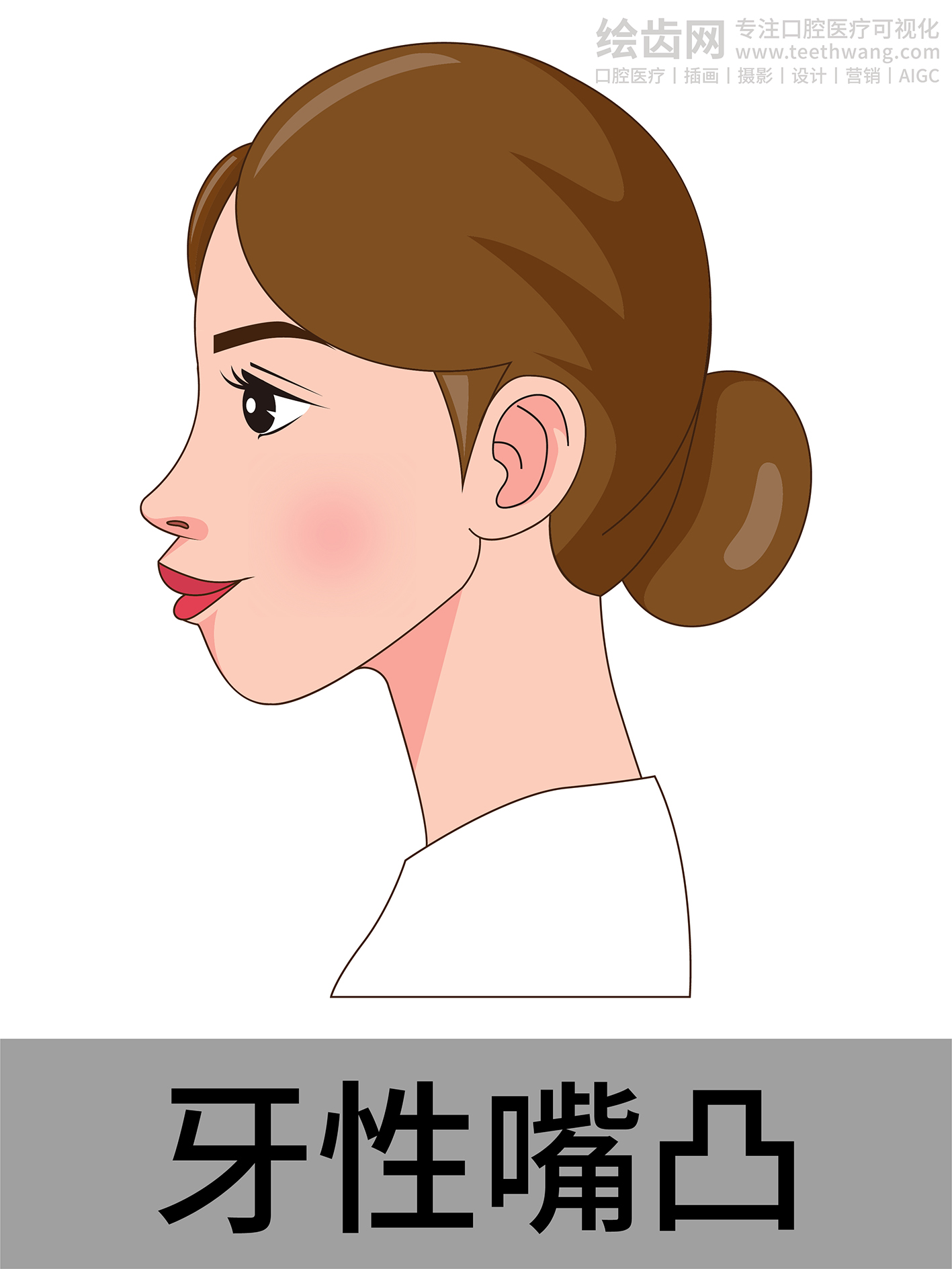 女孩侧脸 牙齿矫正类型 口腔医美插画