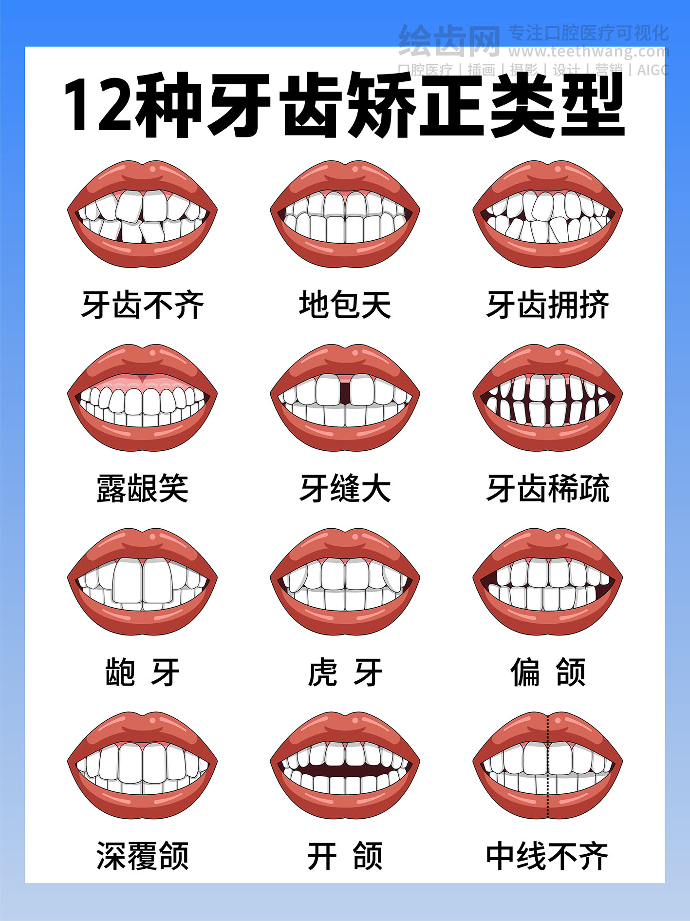 12种牙齿矫正类型