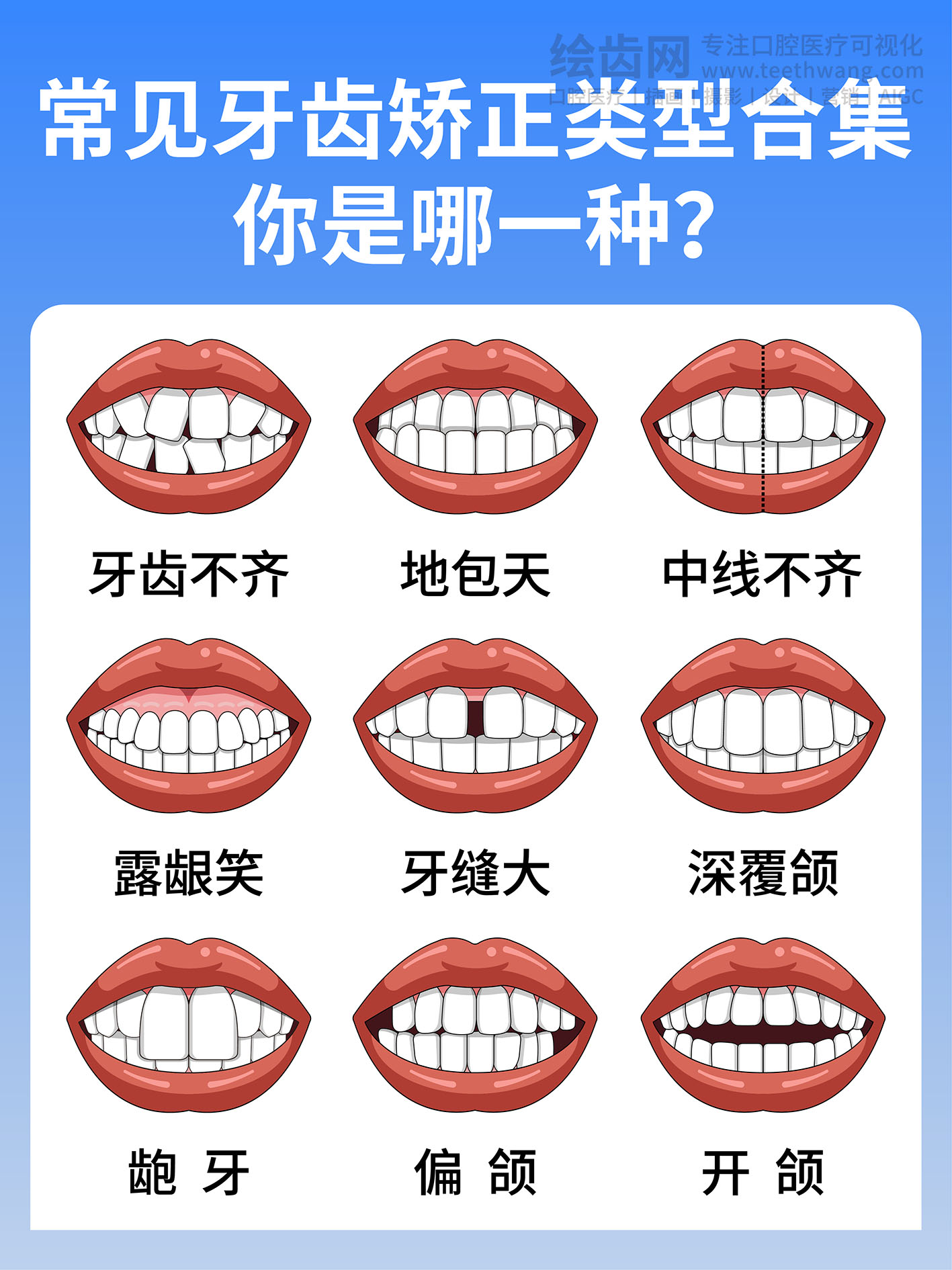 常见牙齿矫正类型合集