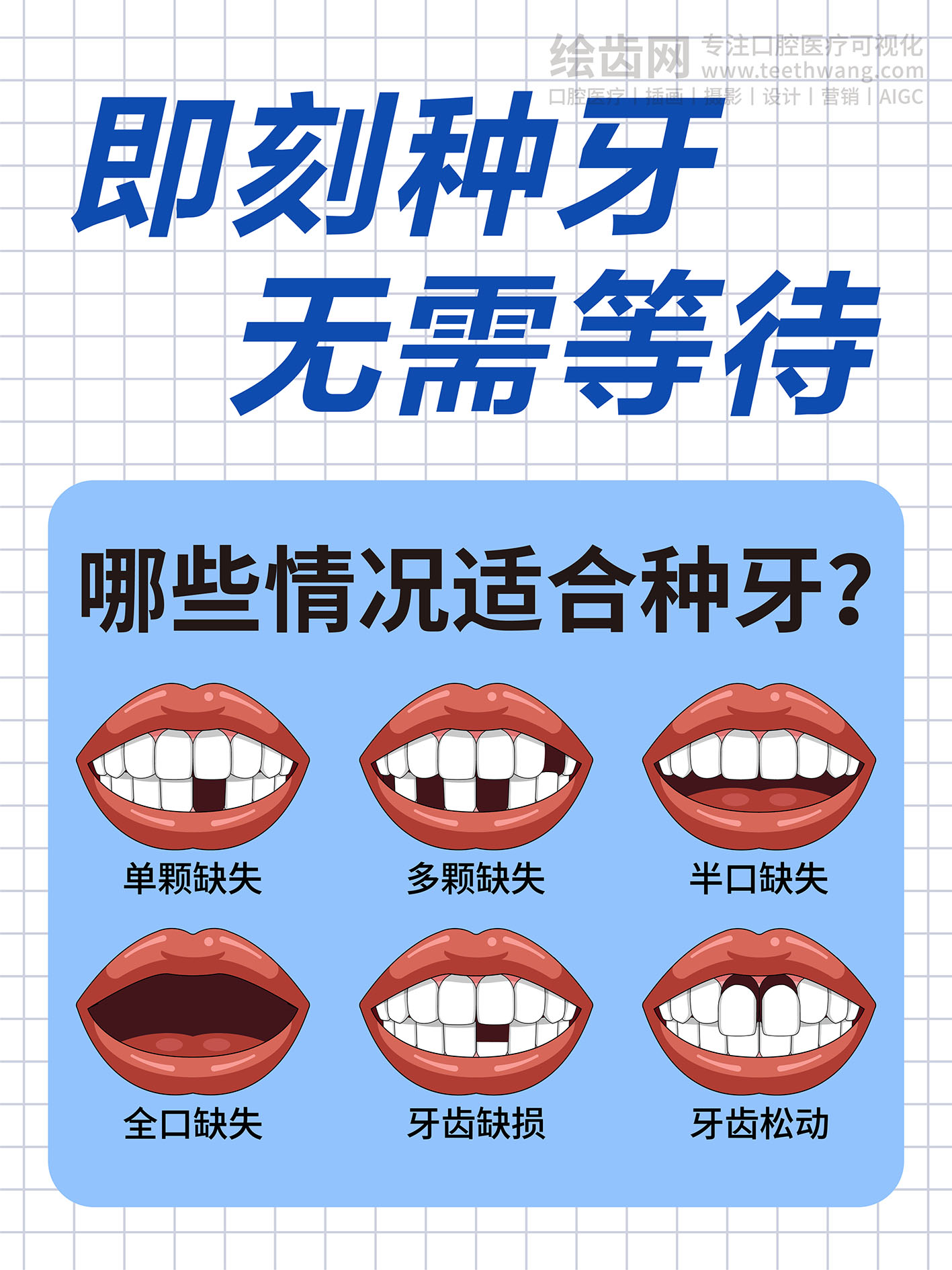 即刻种植 无需等待