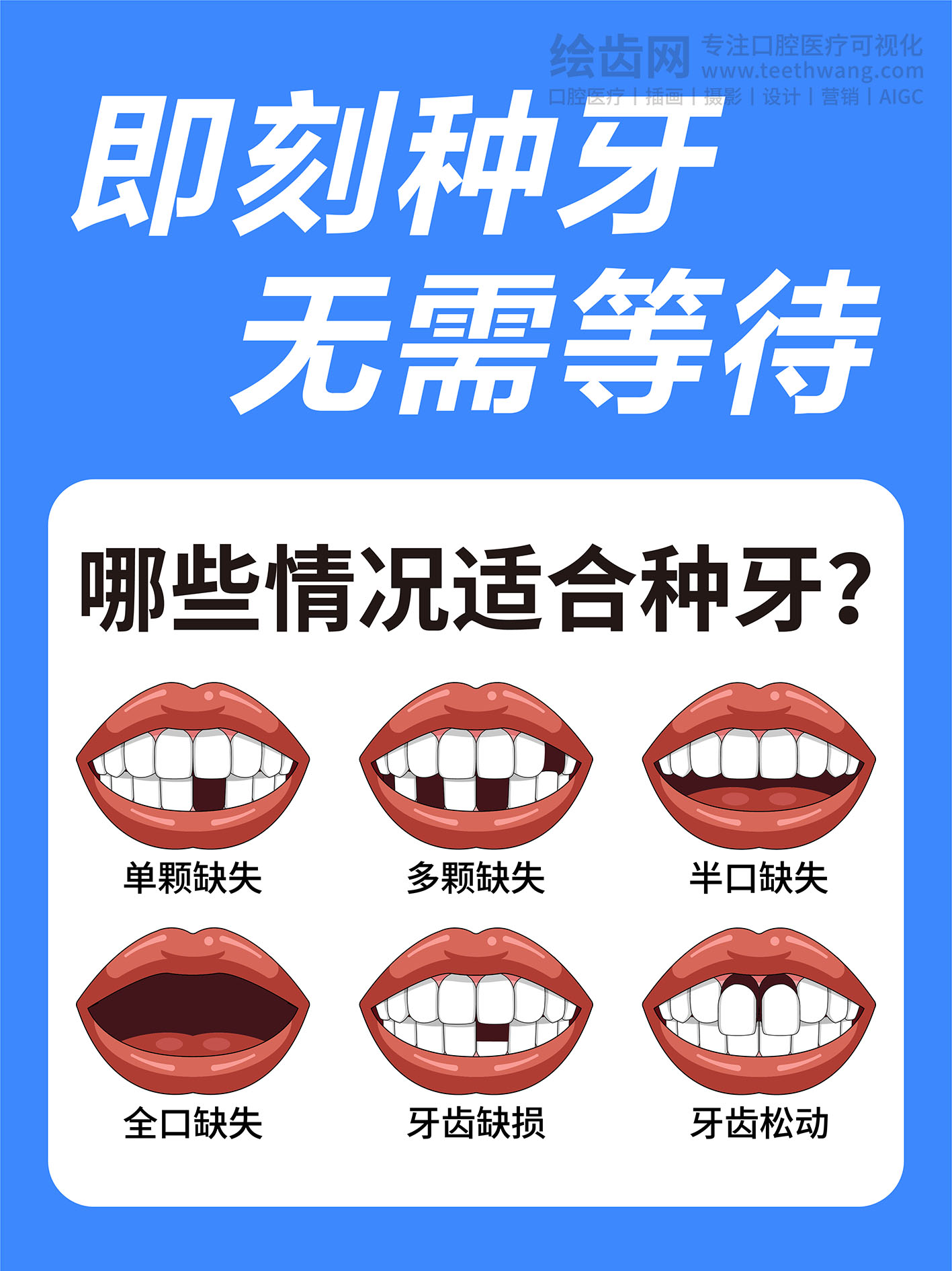 即刻种植 无需等待