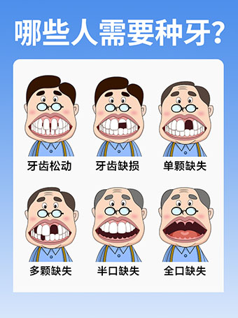 哪些人需要种牙？