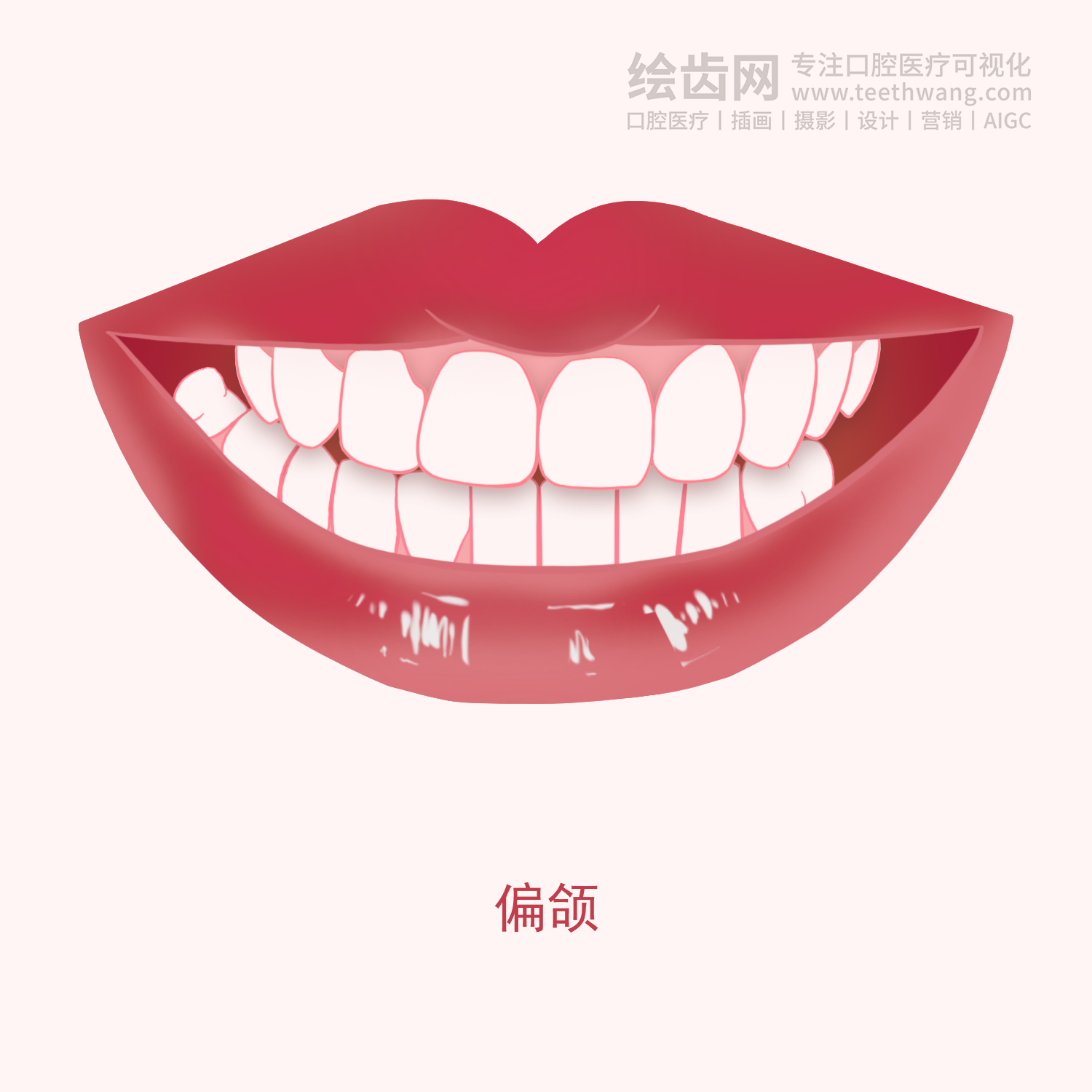 常见牙齿矫正类型有哪些？