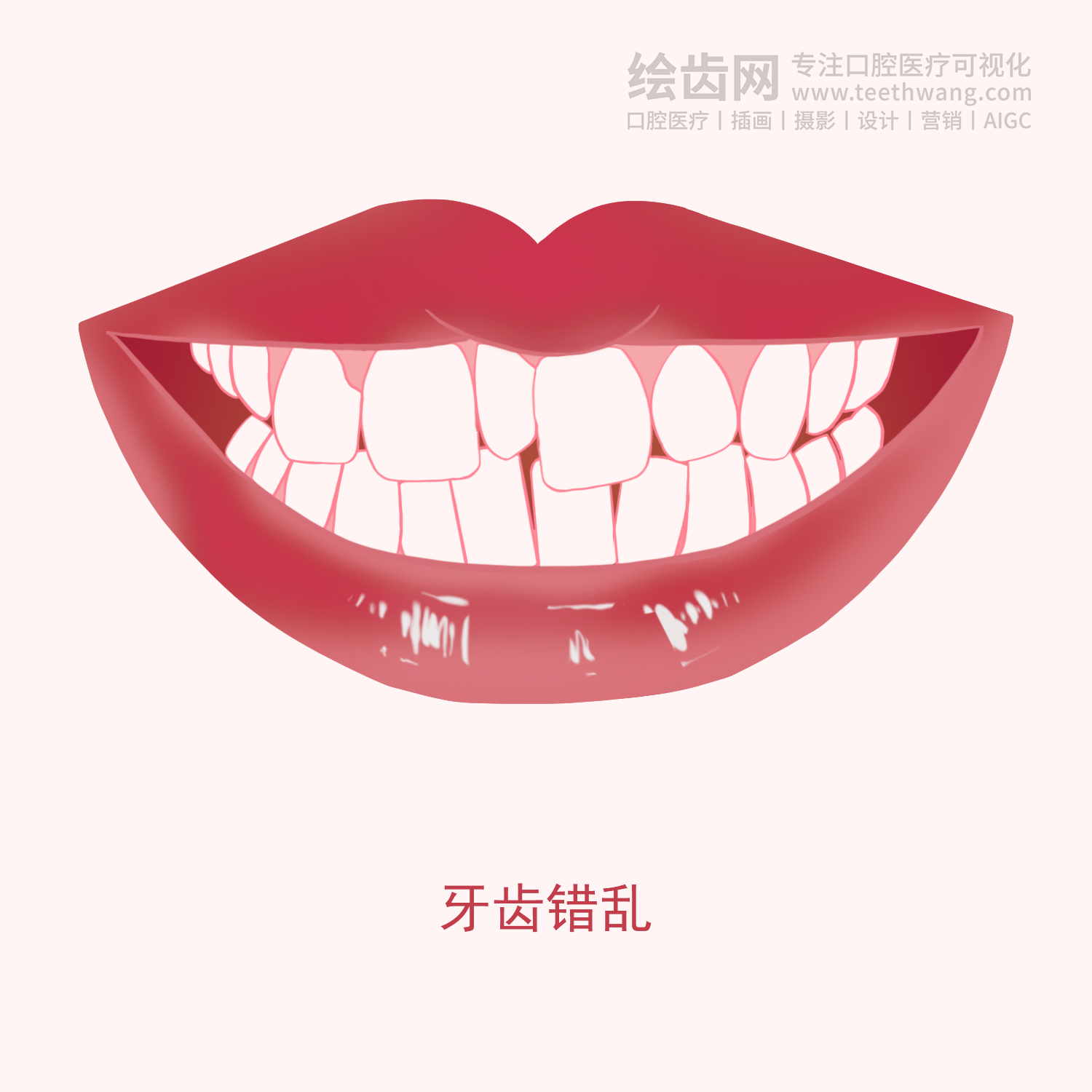 常见牙齿矫正类型有哪些？