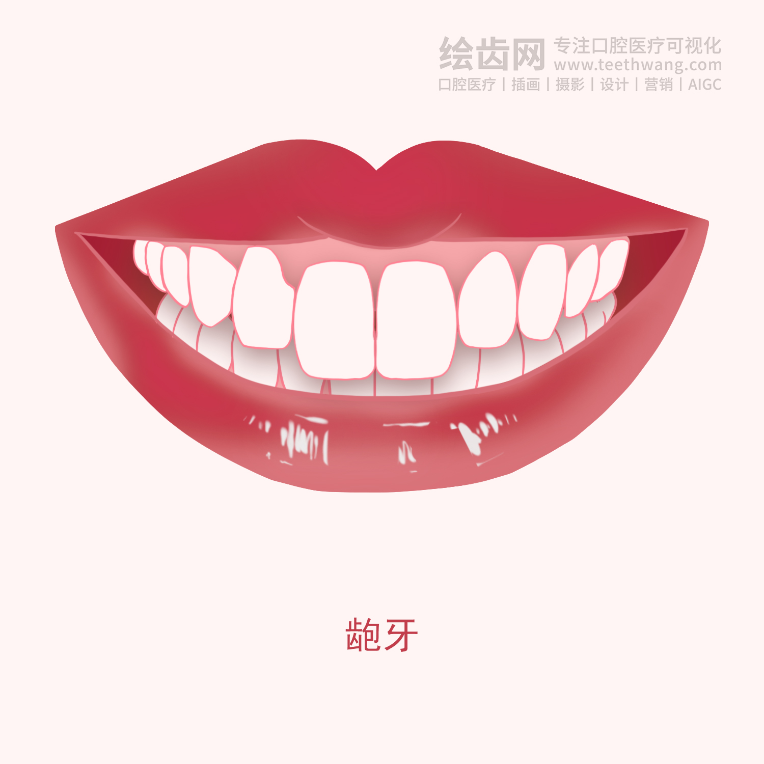 常见牙齿矫正类型有哪些？