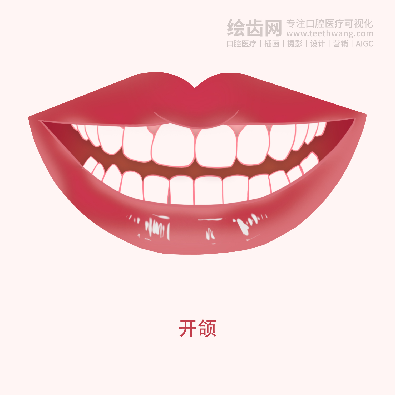 常见牙齿矫正类型有哪些？