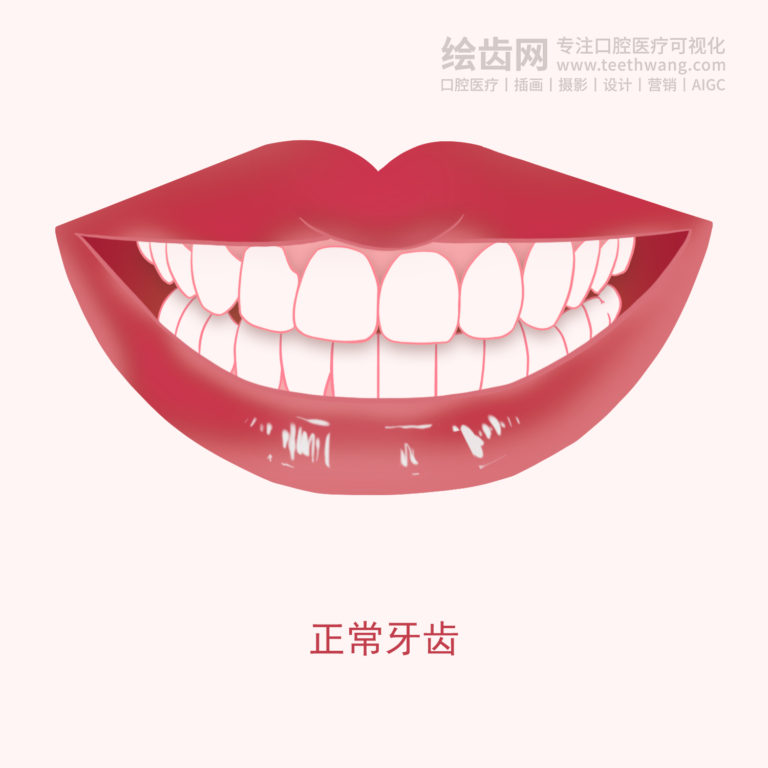 常见牙齿矫正类型有哪些？