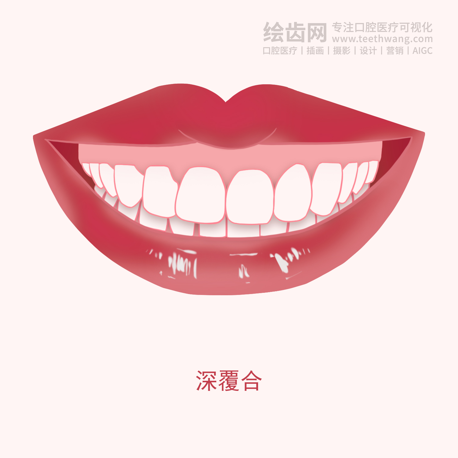 常见牙齿矫正类型有哪些？