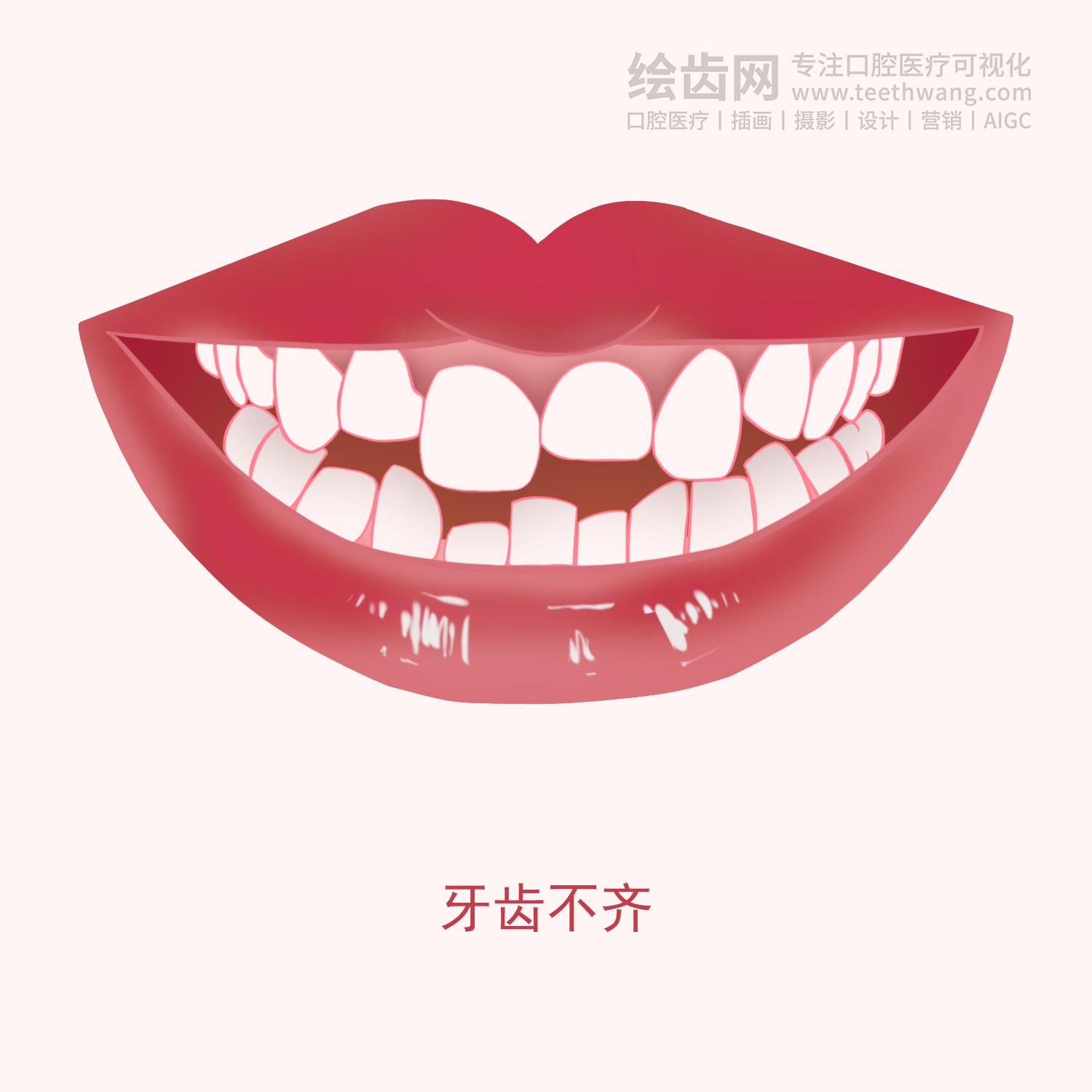 常见牙齿矫正类型有哪些？