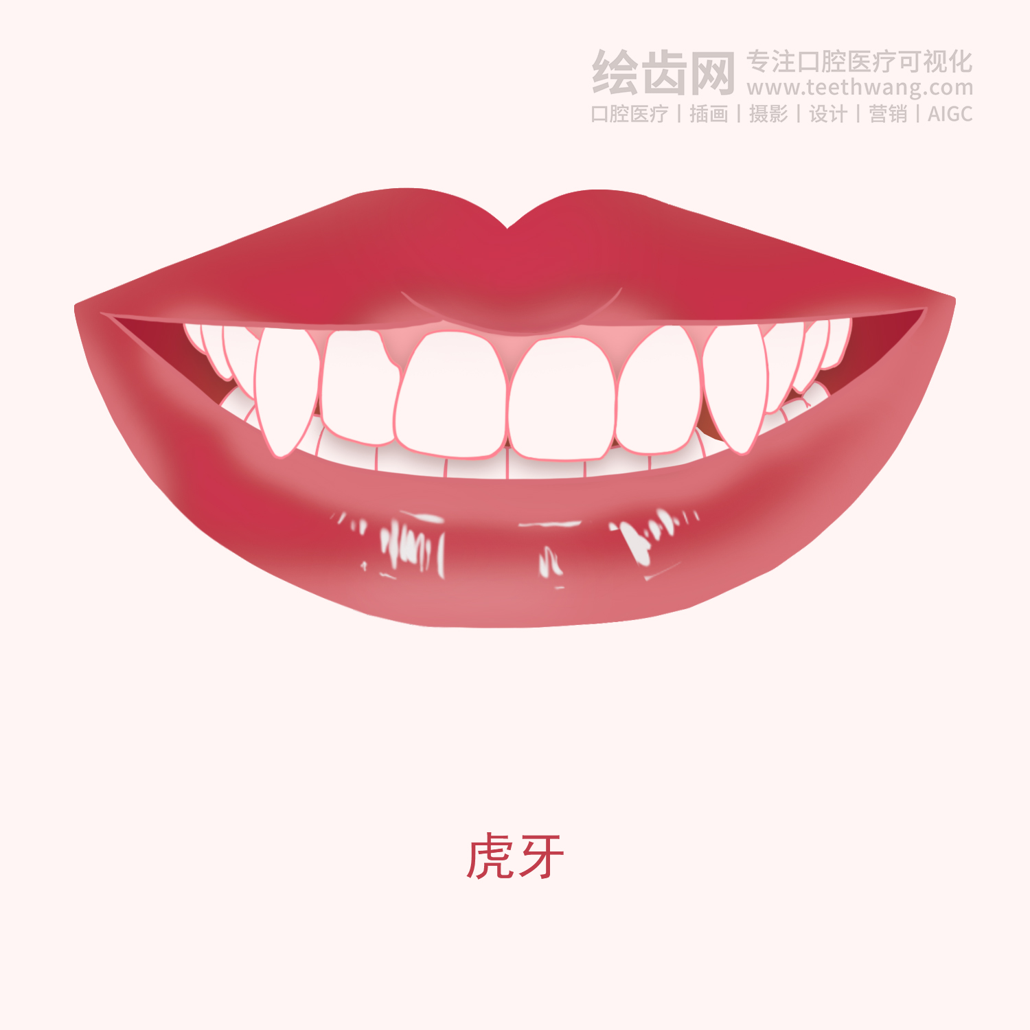 常见牙齿矫正类型有哪些？